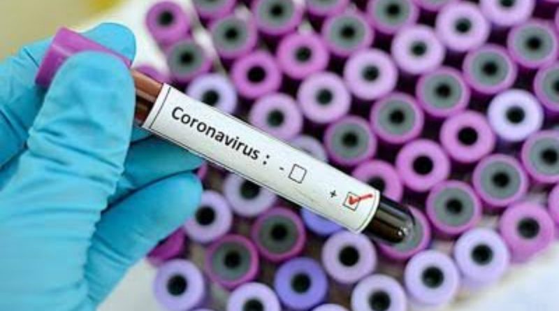 Retired ABU Scientist Claims to have Cure for COVID-19 5